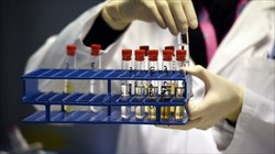 نظرسنجی محرمانه، دوپینگ گسترده میان ورزشکاران بریتانیایی را فاش کرد